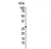 Western blot testing of human Jurkat cell lysate with Dickkopf-2 antibody. Expected molecular weight: 28-35 kDa.