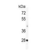 Western blot testing of mouse heart tissue lysate with KCNIP3 antibody. Predicted molecular weight ~29 kDa.