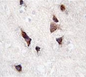IHC testing of FFPE human brain tissue with KCNIP3 antibody. HIER: steam section in pH6 citrate buffer for 20 min and allow to cool prior to staining.