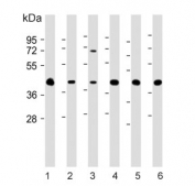 Western blot testing of human 2) HEK293, 2) HeLa, 3) HepG2, 4) U-251 MG, 5) mouse brain and 6) rat brain lysate with GIPC1 antibody. Expected molecular weight: 36-42 kDa.