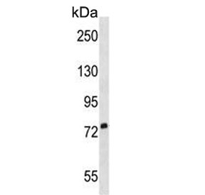 Western blot testing of human T-47D cell lysate with SIGLEC5 antibody. Expected molecular weight: 60-110 kDa depending on glycosylation level.~