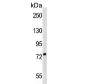 Western blot testing of human T-47D cell lysate with SIGLEC5 antibody. Expected molecular weight: 60-110 kDa depending on glycosylation level.