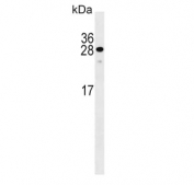 Western blot testing of human WiDr cell lysate with KLF9 antibody. Expected molecular weight: 27-35 kDa.