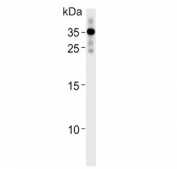 Western blot testing of human LNCaP cell lysate with RNF4 antibody. Expected molecular weight: 15-30 kDa (isoform 1).