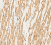 IHC testing of FFPE human heart tissue with RNF4 antibody. HIER: steam section in pH6 citrate buffer for 20 min and allow to cool prior to staining.