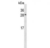 Western blot testing of human A2058 cell lysate with RAB28 antibody. Expected molecular weight: 25-30 kDa.