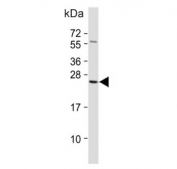 Western blot testing of human kidney tissue lysate with RAB28 antibody. Expected molecular weight: 25-30 kDa.