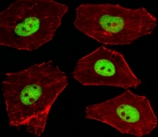 Immunofluorescent staining of human A549 cells with Stk11 antibody (green) and anti-Actin (red).