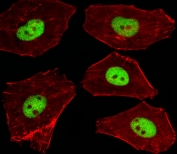 Immunofluorescent staining of human A549 cells with Stk11 antibody (green) and anti-Actin (red).