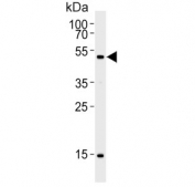 Western blot testing of human NCI-H1299 cell lysate with Stk11 antibody. Predicted molecular weight ~49 kDa.