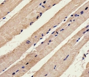 IHC testing of FFPE mouse skeletal muscle tissue with Stk11 antibody. HIER: steam section in pH6 citrate buffer for 20 min and allow to cool prior to staining.