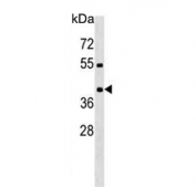 Western blot testing of human MDA-MB-453 cell lysate with PRRT2 antibody. Predicted molecular weight ~35 kDa.