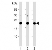 Western blot testing of 1) human HeLa, 2) human K562 and 3) rat PC-12 cell lysate with LZIC antibody. Predicted molecular weight ~21 kDa.