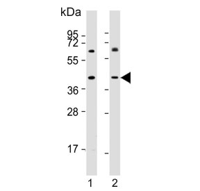 Western blot testing of human 1) LNCaP and 2) MDA-MB-231 cell lysate with LGASLS8 antibody. Expected molecular weight ~36/40 kDa (isoforms 1/2).~