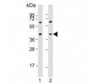 Western blot testing of human 1) LNCaP and 2) MDA-MB-231 cell lysate with LGASLS8 antibody. Expected molecular weight ~36/40 kDa (isoforms 1/2).