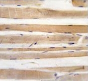IHC testing of FFPE human skeletal muscle tissue with ATG4A antibody. HIER: steam section in pH6 citrate buffer for 20 min and allow to cool prior to staining.