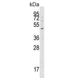 Western blot testing of human Jurkat cell lysate with ATG4A antibody. Predicted molecular weight ~45 kDa, commonly observed between 45-60 kDa.