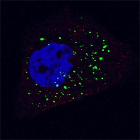 Immunofluorescent staining of fixed and permeabilized human U-251 cells (treated with 50 uM Chloroquine for 16 hr) with ATG4B antibody (green) and Hoechst 33342 nuclear stain (blue).