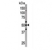Western blot testing of mouse liver tissue lysate with ATG4C antibody. Predicted molecular weight ~52 kDa.