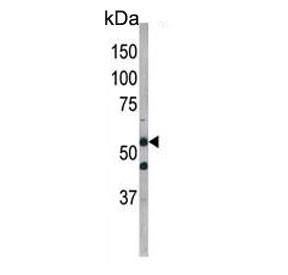 Western blot testing of mouse kidney tissue lysate with ATG4D antibody. Expected molecular weight: 53-56 kDa.