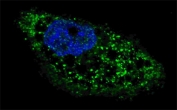 Immunofluorescent staining of fixed and permeabilized human U-251 cells (treated with 50 uM Chloroquine for 16 hr) with Autophagin 4D antibody (green) and Hoechst 33342 nuclear stain (blue).