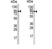Western blot testing of human A2058 (left) and A375 (right) cell lysate with ATG9A antibody. Expected molecular weight: 94-110 kDa depending on glycosylation level.