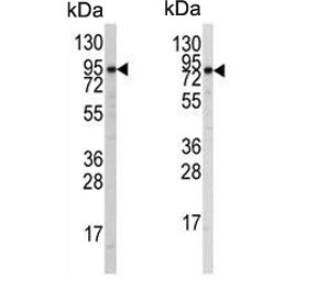 Western blot testing of human A2058 (left) and A375 (right) cell lysate with ATG9A antibody. Predicted molecular weight ~94 kDa.