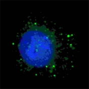 Immunofluorescent staining of fixed and permeabilized human U-251 cells (treated with 50 uM Chloroquine for 16 hr) with Rubicon antibody (green) and Hoechst 33342 nuclear stain (blue).
