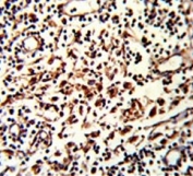IHC testing of FFPE human lymph tissue with Rubicon antibody. HIER: steam section in pH6 citrate buffer for 20 min and allow to cool prior to staining.