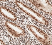 IHC testing of FFPE human uterus tissue with MOX-2 antibody. HIER: steam section in pH9 EDTA for 20 min and allow to cool prior to staining.