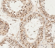 IHC testing of FFPE human testis tissue with ALKBH5 antibody. HIER: steam section in pH6 citrate buffer for 20 min and allow to cool prior to staining.