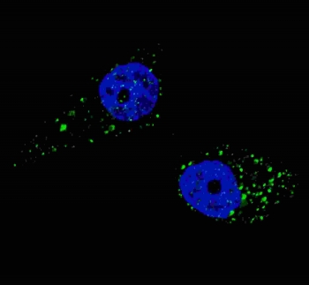 Immunofluorescent staining of fixed and permeabilized human U-251 cells (treated with 50 uM Chloroquine for 16 hr) with UVRAG antibody (green) and Hoechst 33342 nuclear stain (blue).