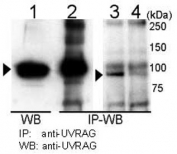 Immunoprecipitation and western blot analysis using UVRAG antibody with 293T cells. UVRAG is immunoprecipitated (Lane 2) and detected in 293T cell transiently transfected with mouse UVRAG (Lane 1). Detection of endogenous UVRAG is shown in 293T cells (Lane 3) but is reduced by UVRAG siRNA transfection (Lane 4). Data courtesy of Dr. Hong-Gang Wang, Moffitt Cancer Center, Tampa, FL.