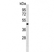 Western blot testing of human WiDr lysate with ERLIN2 antibody. Predicted molecular weight: ~38 kDa, routinely observed at ~43 kDa.