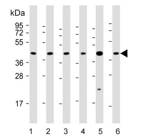 Western blot testing of 1) human 293T, 2) human A431, 3) mouse C2C12, 4) mouse NIH 3T3, 5) human breast and 6) human placenta lysate with ERLIN2 antibody. Predicted molecular weight: ~38 kDa, rountinely observed at ~43 kDa.~