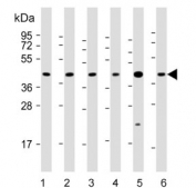 Western blot testing of 1) human 293T, 2) human A431, 3) mouse C2C12, 4) mouse NIH 3T3, 5) human breast and 6) human placenta lysate with ERLIN2 antibody. Predicted molecular weight: ~38 kDa, routinely observed at ~43 kDa.