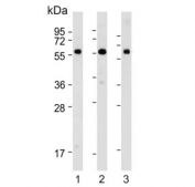 Western blot testing of human 1) HeLa, 2) SH-SY5Y and 3) placenta lysate with BRD9 antibody. Predicted molecular weight ~67 kDa, commonly observed at 67-85 kDa.