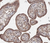 IHC testing of FFPE human placenta tissue with BRD9 antibody. HIER: steam section in pH9 EDTA for 20 min and allow to cool prior to staining.