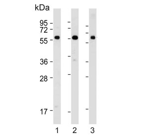 Western blot testing of human 1) HeLa, 2) SH-SY5Y and 3) placenta lysate with BRD9 antibody. Predicted molecular weight ~67 kDa.
