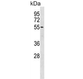 Western blot testing of mouse Neuro-2a cell lysate with BRD9 antibody. Predicted molecular weight ~67 kDa.