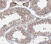 IHC testing of FFPE human testis tissue with BRD9 antibody. HIER: steam section in pH9 EDTA for 20 min and allow to cool prior to staining.