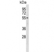 Western blot testing of mouse Neuro-2a cell lysate with BRD9 antibody. Predicted molecular weight ~67 kDa, commonly observed at 67-85 kDa.