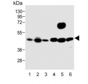 Western blot testing of 1) human A431, 2) human HeLa, 3) human Jurkat, 4) mouse NIH 3T3, 4) mouse spleen and 6) rat C6 cell lysate with MAP2K1 antibody. Predicted molecular weight ~43 kDa.
