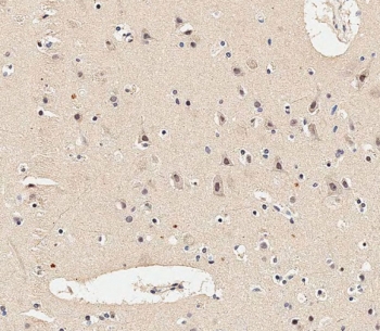 IHC testing of FFPE human brain tissue with MAP2K1 antibody. HIER: steam section in pH9 EDTA for 20 min and allow to cool prior to staining.