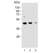 Western blot testing of 1) human MDA-MB-231, 2) mouse NIH 3T3 and 3) rat C6 cell lysate with MAP2K1 antibody. Predicted molecular weight ~43 kDa.
