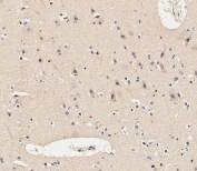 IHC testing of FFPE human brain tissue with MAP2K1 antibody. HIER: steam section in pH9 EDTA for 20 min and allow to cool prior to staining.
