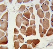 IHC testing of FFPE human skeletal muscle tissue with RuvB-like 1 antibody. HIER: steam section in pH6 citrate buffer for 20 min and allow to cool prior to staining.