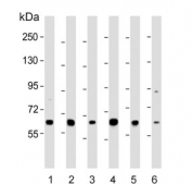 Western blot testing of human 1) 293T, 2) CCRF-CEM, 3) HeLa, 4) HepG2, 5) Jurkat and 6) MCF7 cell lysate with RNF31 antibody. Predicted molecular weight ~120 kDa (isoform 1), ~58 kDa (isoform 2) and ~102 kDa (isoform 3).