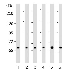 Western blot testing of human 1) 293T, 2) CCRF-CEM, 3) HeLa, 4) Jurkat, 5) MDA-MB-453 and 6) MCF7 cell lysate with RNF31 antibody. Predicted molecular weight ~120 kDa (isoform 1), ~58 kDa (isoform 2) and ~102 kDa (isoform 3).~