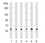 Western blot testing of human 1) 293T, 2) CCRF-CEM, 3) HeLa, 4) Jurkat, 5) MDA-MB-453 and 6) MCF7 cell lysate with RNF31 antibody. Predicted molecular weight ~120 kDa (isoform 1), ~58 kDa (isoform 2) and ~102 kDa (isoform 3).